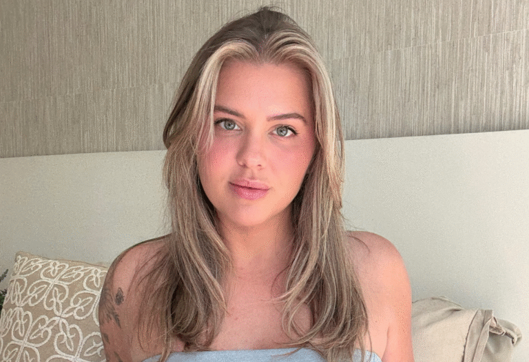 Wisconsin Tiff Featured in the Daily Mail for Radical Rib-Sculpt Surgery